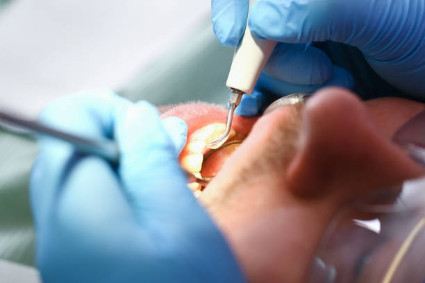 Best Affordable Emergency Dental Care  in Horseshoe Bend, AR