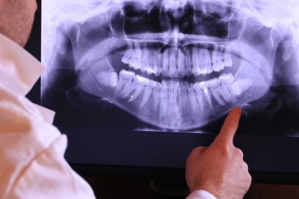 Teeth Whitening in AR