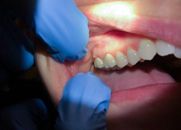 Best Emergency Gum Pain Relief  in Horseshoe Bend, AR